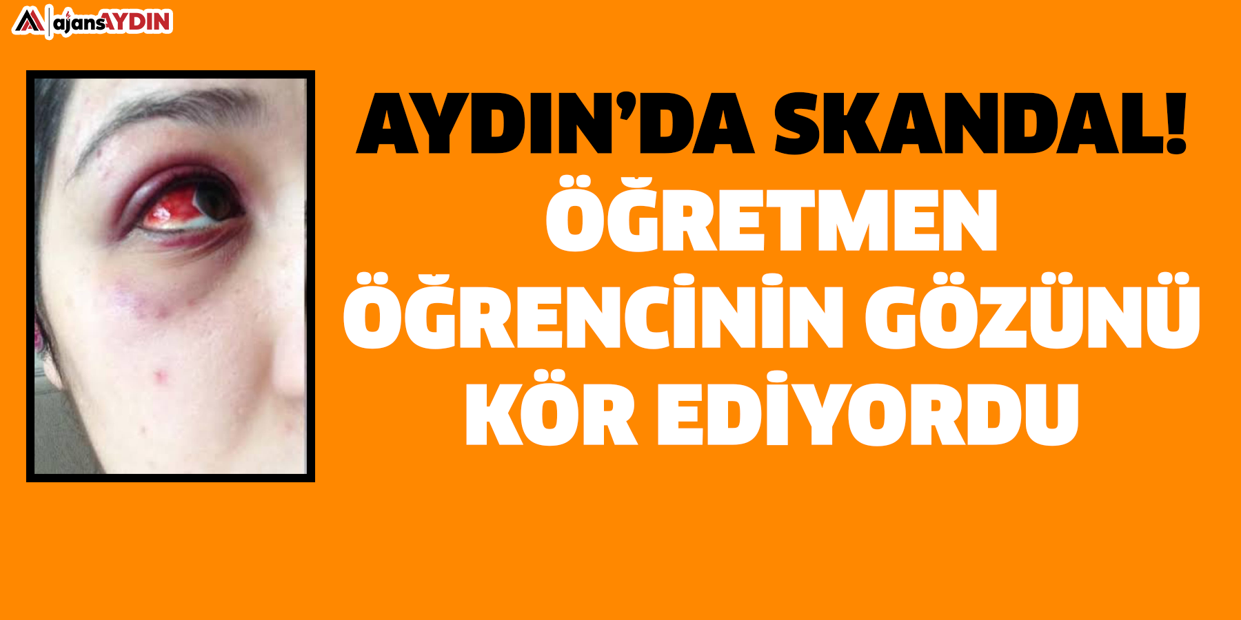 Aydın'da skandal!  Öğretmen öğrencinin gözünü kör ediyordu