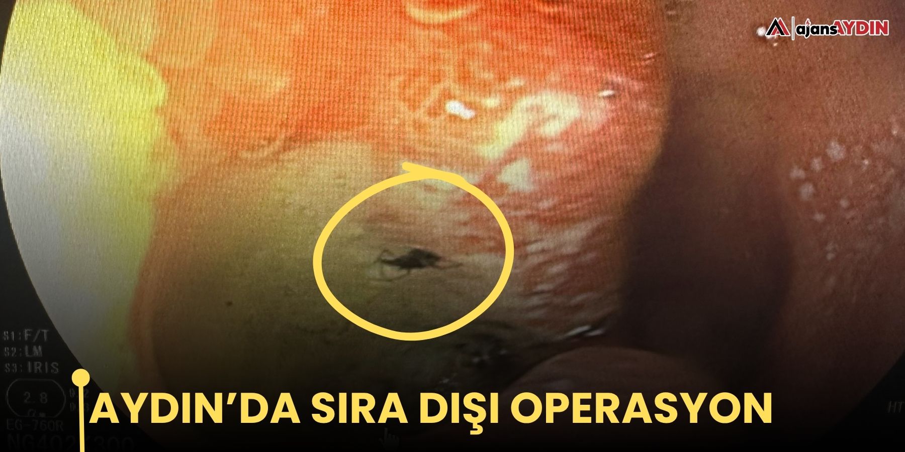 Aydın’da sıra dışı operasyon