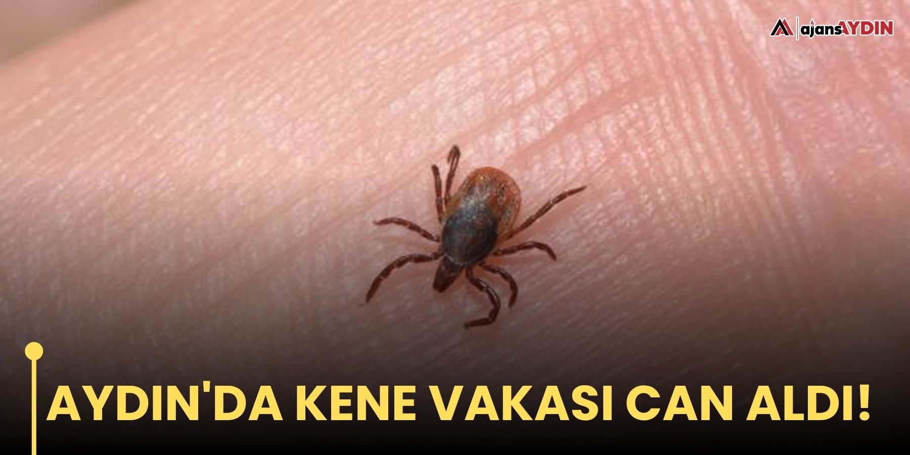 Aydın'da kene vakası can aldı!